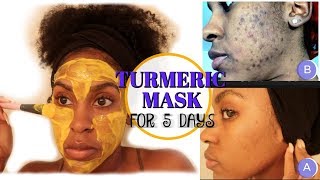 I Used a TURMERIC MASK for 1 Week and THIS HAPPENED  How to Fade Dark Spots [upl. by Nananne]