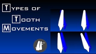 Types Of Tooth Movements  Essential Biomechanics [upl. by Tamiko238]