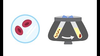 High Liver Enzymes  Aspartate vs Alanine Aminotransferase AST vs ALT  Causes [upl. by Othello953]