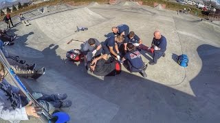 DAD BREAKS HIS LEG IN TWO PLACES AT SKATE PARK WITH FOUR KIDS [upl. by Herrera]