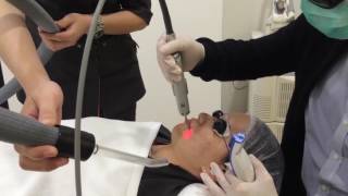 Fotona 4D Laser Skin Tightening  NonSurgical Facelift amp Skin Tightening [upl. by Neiviv]