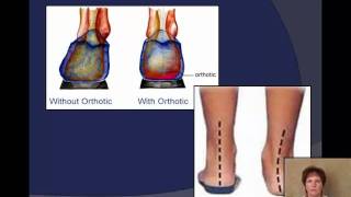 Plantar Fasciitis Pain Relief Treatments  Ask Doctor Jo [upl. by Brena]