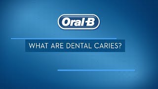 What are Dental Caries Treatments Signs and Symptoms  OralB [upl. by Gimpel]