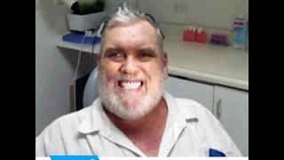 Los Algodones Mexico Dental Solutions Review from actual patients [upl. by Khai]