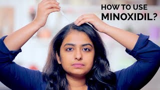 How To Use Minoxidil  Hair Regrowth  Skin Diaries [upl. by Ingra]