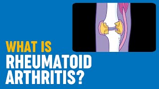 What is rheumatoid arthritis [upl. by Immij198]