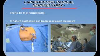 Understanding ERCP Endoscopic Retrograde Cholangiopancreatography [upl. by Africah662]