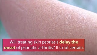 The quotWho What Why” of Psoriatic Arthritis [upl. by Hollenbeck770]