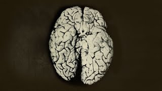 A Scientist Spilled 2 Drops Organic Mercury On Her Hand This Is What Happened To Her Brain [upl. by Lebasy]