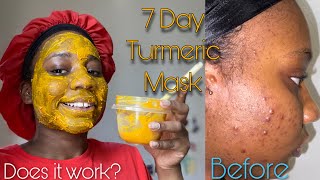 7 Day Turmeric Face Mask For Dark Spots  Honest Review [upl. by Ynabe]