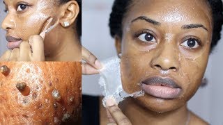 DIY Milk Blackhead Remover Peel Off Mask [upl. by Esej]