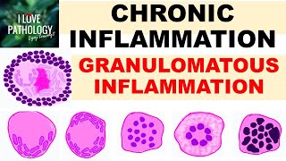 Introduction to Cancer Biology Part 1 Abnormal Signal Transduction [upl. by Hayimas598]