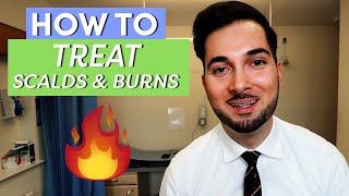 Burns Everything You Need To Know Especially Treatment  Paramedic Approved [upl. by Slerahc]