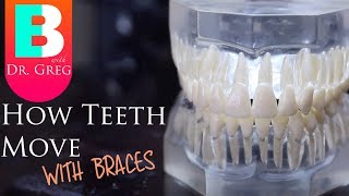 BRACES EXPLAINED How Teeth Move  Braces Work [upl. by Ciel]