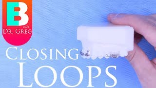 BRACES EXPLAINED Closing Loops [upl. by Cavallaro]