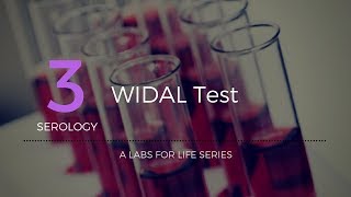 Widal test [upl. by Akinorev]