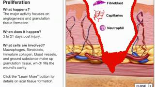 Stages of Wound Healing Process [upl. by Colier]