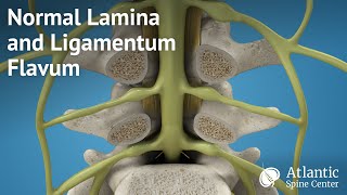 Ligaments of the Elbow [upl. by Esetal574]