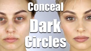 How To Conceal Dark Circles Under Eyes  Alexandra Anele [upl. by Melborn]