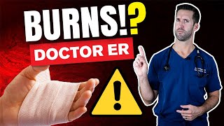 How to Treat a Second Degree Burn  Auburn Medical Group [upl. by Ethelda]