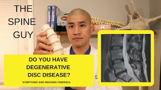 Lumbar Degenerative Disc Disease Part 1 Symptoms and Imaging [upl. by Atnuhs110]