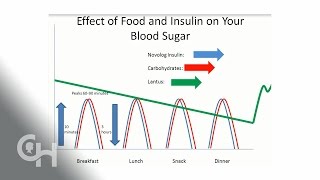 What Are Basal Insulins and Should I Use One [upl. by Aiz]