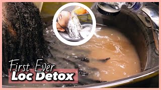 Loc Detox ACV ACVRinse Locs [upl. by Ecirtra541]