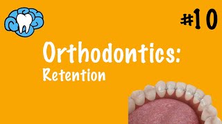 Orthodontics  Retention  INBDE ADAT [upl. by Sorvats]