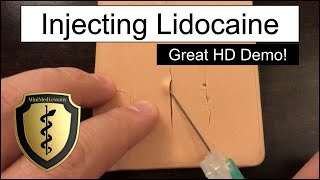 Closing a Laceration Using a Skin Stapler  Stepbystep instructions [upl. by Anaeerb702]